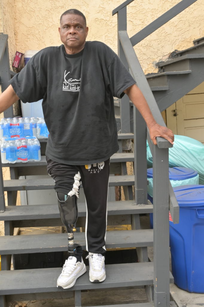 Monday, June 28, 2025. Leibo Glover at his home in Los Angeles, California. The security professional's leg was amputated below the knee. 